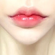 입성형,입술주름,입술라인,입꼬리리프팅,입술꼬리,벨라필,비순각수술