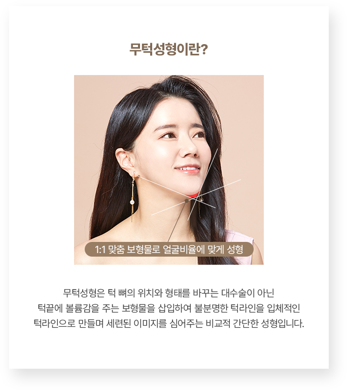 골든뷰 무턱성형이란?