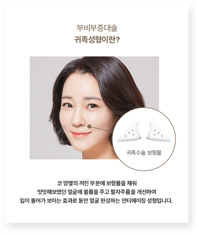 부비부증대술 골든뷰 귀족성형이란?