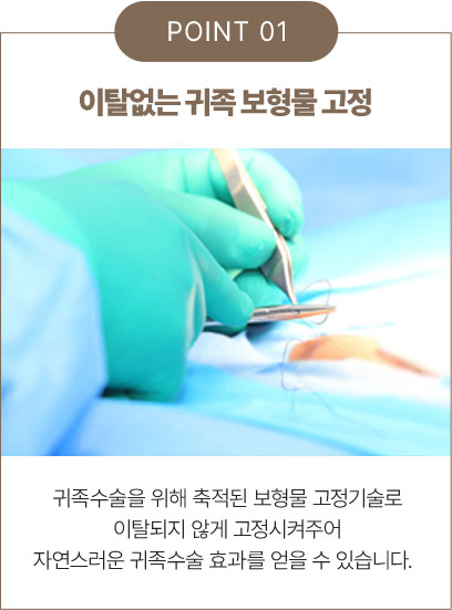 이탈없는 귀족 보형물 고정